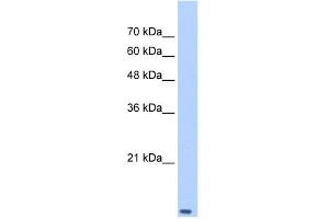 WB Suggested Anti-TCEB2 Antibody Titration: 0. (TCEB2 抗体  (Middle Region))