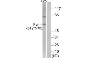 Western blot analysis of extracts from LOVO cells, using Fyn (Phospho-Tyr530) antibody (ABIN5975908). (FYN 抗体  (pTyr530))