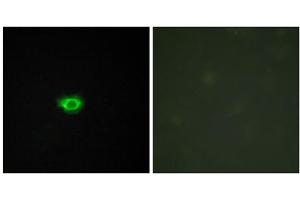Immunofluorescence analysis of HUVEC cells, using GP108 antibody. (GPR108 抗体  (Internal Region))
