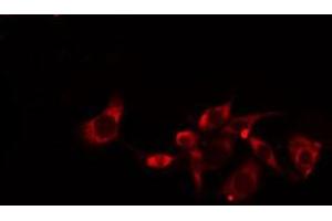 ABIN6275148 staining  Hela cells by IF/ICC. (GJC1 抗体  (C-Term))