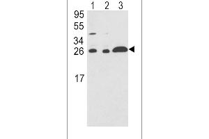 Western blot analysis of ARHGDIA Antibody in A375(lane 1),HL-60(lane 2),Ramos(lane 3) cell line lysates (35ug/lane) (ARHGDIA 抗体  (C-Term))