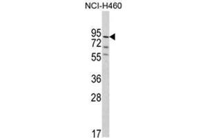 Western Blotting (WB) image for anti-Pleckstrin Homology Domain Containing, Family G (With RhoGef Domain) Member 6 (PLEKHG6) (N-Term) antibody (ABIN453207)