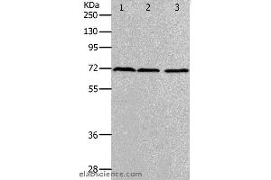 Western blot analysis of K562, hela and 293T cell, using PRMT5 Polyclonal Antibody at dilution of 1:400 (PRMT5 抗体)