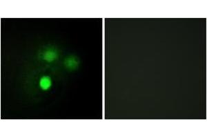 Immunofluorescence analysis of HuvEc cells, using KNTC2 Antibody. (NDC80 抗体  (AA 351-400))