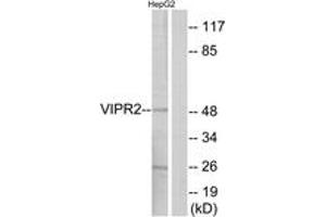 Western blot analysis of extracts from HepG2 cells, using VIPR2 Antibody. (VIPR2 抗体)
