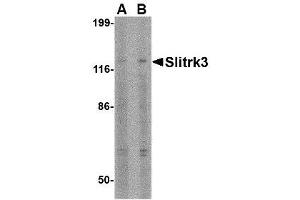 Image no. 1 for anti-SLIT and NTRK-Like Family, Member 3 (SLITRK3) (C-Term) antibody (ABIN1493361) (SLITRK3 抗体  (C-Term))