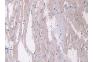 IHC-P analysis of Rat Heart Tissue, with DAB staining. (Angiopoietin 1 抗体  (AA 304-450))