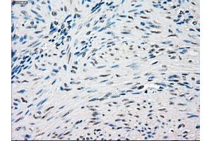 Immunohistochemical staining of paraffin-embedded Ovary tissue using anti-SSBmouse monoclonal antibody. (SSB 抗体)