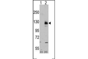 Image no. 2 for anti-Transient Receptor Potential Cation Channel, Subfamily M, Member 8 (TRPM8) (C-Term) antibody (ABIN360717) (TRPM8 抗体  (C-Term))