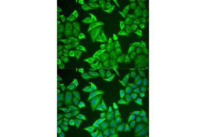 Immunofluorescence analysis of U2OS cells using NGB antibody (ABIN5973872). (Neuroglobin 抗体)