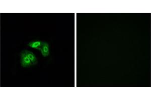 Immunofluorescence analysis of A549 cells, using VN1R5 antibody. (VN1R5 抗体)