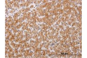 Image no. 1 for anti-Receptor-Interacting Serine-threonine Kinase 4 (RIPK4) (AA 675-785) antibody (ABIN466213) (RIPK4 抗体  (AA 675-785))