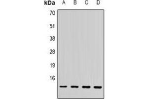 Western blot analysis of SSNA1 expression in PC3 (A), MCF7 (B), mouse spleen (C), rat brain (D) whole cell lysates. (SSNA1 抗体)