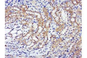 anti-Ribosomal Protein S6 Kinase, 70kDa, Polypeptide 2 (RPS6KB2) (pSer447), (pThr444) antibody