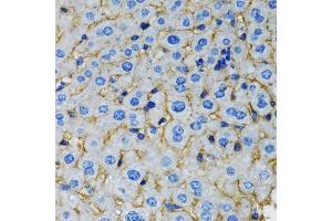 Immunohistochemistry of paraffin-embedded rat liver using RAF1 antibody (ABIN5970053) at dilution of 1/100 (40x lens). (RAF1 抗体  (C-Term))