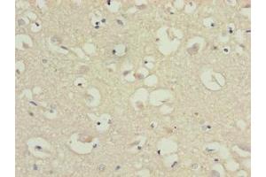 Immunohistochemistry of paraffin-embedded human brain tissue using ABIN7147813 at dilution of 1:100 (CMTM5 抗体  (AA 1-35))