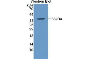 Western blot analysis of the recombinant protein. (CPN2 抗体  (AA 249-540))