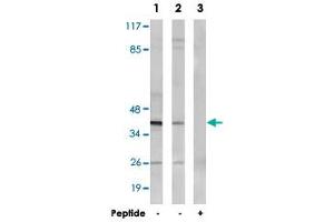 Western blot analysis of extracts from MCF-7 cells (Lane 1 and lane 3) and HepG2 cells (Lane 2), using NT5C1A polyclonal antibody . (NT5C1A 抗体)
