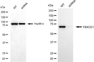 Western blotting analysis using FBXO21 antibody (ABIN7798555). (FBXO21 抗体)