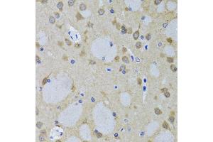 Immunohistochemistry of paraffin-embedded mouse brain using YWHAZ antibody (ABIN5975846) at dilution of 1/100 (40x lens). (14-3-3 zeta 抗体)