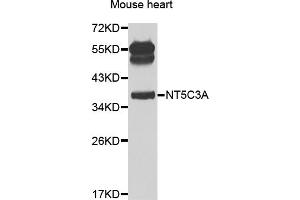 Western blot analysis of extracts of mouse heart, using NT5C3A antibody (ABIN2564236) at 1:1000 dilution. (NT5C3 抗体)