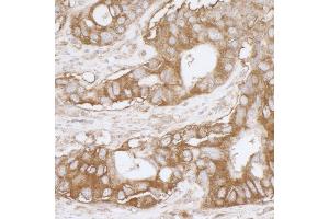 Immunohistochemistry (IHC) image for anti-Major Vault Protein (MVP) (AA 843-893) antibody (ABIN7453922) (MVP 抗体  (AA 843-893))