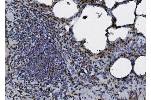 IHC analysis of hnRNP D/AUF1/HNRNPD using anti-hnRNP D/AUF1/HNRNPD antibody (ABIN7602591). (HNRNPD/AUF1 抗体  (AA 88-246))