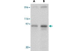 Western blot analysis of NUP107 in A-549 cell lysate with NUP107 polyclonal antibody  at (A) 1 and (B) 2 ug/mL . (NUP107 抗体  (Internal Region))
