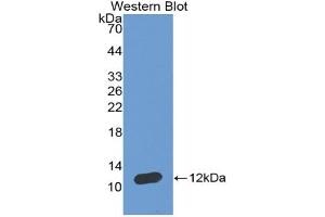 Western blot analysis of the recombinant protein. (NPPA 抗体  (AA 25-122))