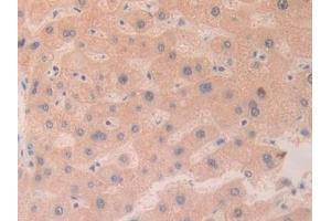 Detection of CHRD in Human Liver Tissue using Polyclonal Antibody to Chordin (CHRD) (Chordin 抗体  (AA 700-918))
