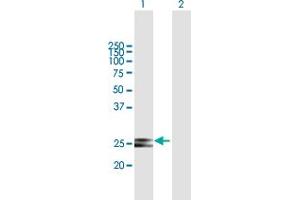 Western Blot analysis of HSCB expression in transfected 293T cell line by HSCB MaxPab polyclonal antibody. (HSCB 抗体  (AA 1-235))