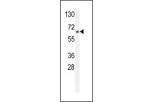 ZNF30 Antibody (N-term) (ABIN654563 and ABIN2844269) western blot analysis in HL-60 cell line lysates (35 μg/lane). (ZFP30 抗体  (N-Term))