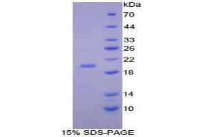 SDS-PAGE analysis of Mouse C/EBP gamma Protein. (CEBPG 蛋白)