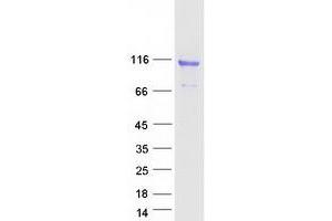 Western Blotting (WB) image for Cartilage Oligomeric Matrix Protein (COMP) protein (Myc-DYKDDDDK Tag) (ABIN2712452)