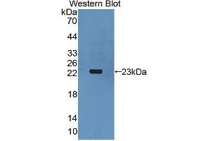 Western Blotting (WB) image for anti-Gremlin 1 (GREM1) antibody (Biotin) (ABIN1175538) (GREM1 抗体  (Biotin))