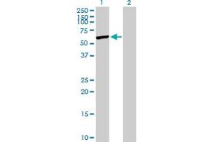 Western Blot analysis of SHMT1 expression in transfected 293T cell line by SHMT1 MaxPab polyclonal antibody. (SHMT1 抗体  (AA 1-483))