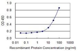 Detection limit for recombinant GST tagged TK1 is 1 ng/ml as a capture antibody. (TK1 抗体  (AA 1-234))