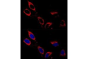 Immunofluorescence (IF) image for anti-ATP Synthase, H+ Transporting, Mitochondrial F1 Complex, alpha Subunit 1, Cardiac Muscle (ATP5A1) antibody (ABIN6137324)