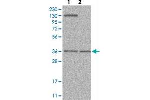 Western blot analysis of Lane 1: Human cell line RT-4 Lane 2: Human cell line U-251MG sp with PVRL1 polyclonal antibody  at 1:100-1:250 dilution.