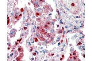 Immunohistochemistry (IHC) image for anti-S100 Calcium Binding Protein A9 (S100A9) (Internal Region) antibody (ABIN335161)