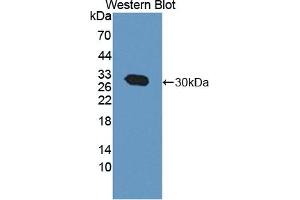 Detection of Recombinant CACYBP, Human using Polyclonal Antibody to Calcyclin Binding Protein (CACYBP) (CACYBP 抗体  (AA 2-228))