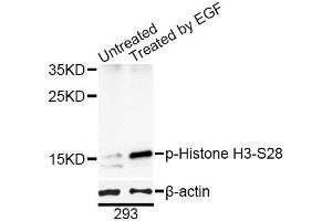 Western blot analysis of extracts of 293T cells, using Phospho-Histone H3-S28 antibody (ABIN5969937) at 1/1000 dilution. (Histone H3.1 抗体  (pSer29))