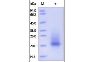SDS-PAGE (SDS) image for KIT Ligand (KITLG) (AA 26-189) (Active) protein (His tag) (ABIN2181732)