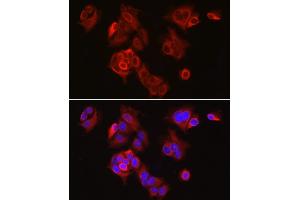 Immunofluorescence (IF) image for anti-Solute Carrier Family 7 (Cationic Amino Acid Transporter, Y+ System), Member 5 (SLC7A5) (AA 1-125) antibody (ABIN1682793)