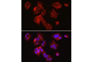 Immunofluorescence analysis of MCF7 cells using SLC7 Rabbit pAb (ABIN3016800, ABIN3016801, ABIN1682793 and ABIN6219842) at dilution of 1:300 (40x lens). (SLC7A5 抗体  (AA 1-125))