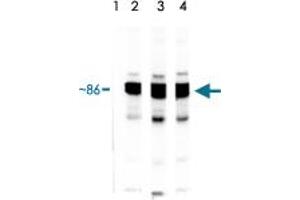 Lane 1 : HSP90 protein standard stressgen. (HSP90 alpha/beta 抗体)