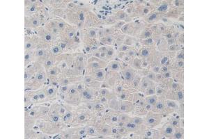 Immunohistochemistry (IHC) image for anti-G Protein-Coupled Receptor Kinase 4 (GRK4) (AA 187-449) antibody (ABIN5013580)