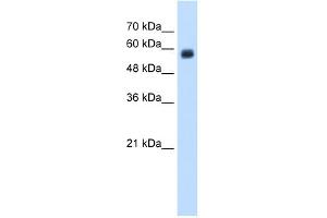 WB Suggested Anti-CLEC4M Antibody Titration:  1.