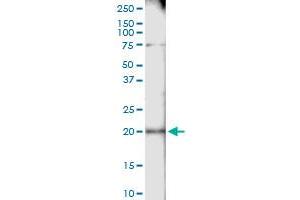 Immunoprecipitation of CETN1 transfected lysate using anti-CETN1 MaxPab rabbit polyclonal antibody and Protein A Magnetic Bead , and immunoblotted with CETN1 purified MaxPab mouse polyclonal antibody (B01P) . (Centrin 1 抗体  (AA 1-172))
