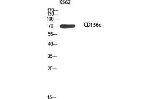 Western Blot (WB) analysis of K562 using CD156c antibody. (ADAM10 抗体)